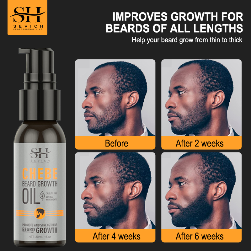 Hair Care Oil Serum - Sevich Men Beard Growth Essential Chebe