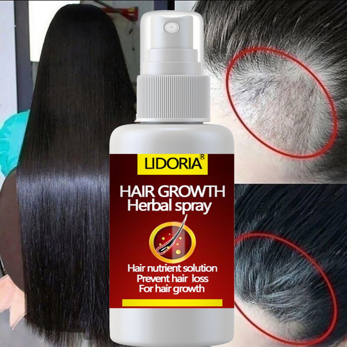 Hair Care Essential Oil Atomizing - Hair Fast Growth and Hair Care