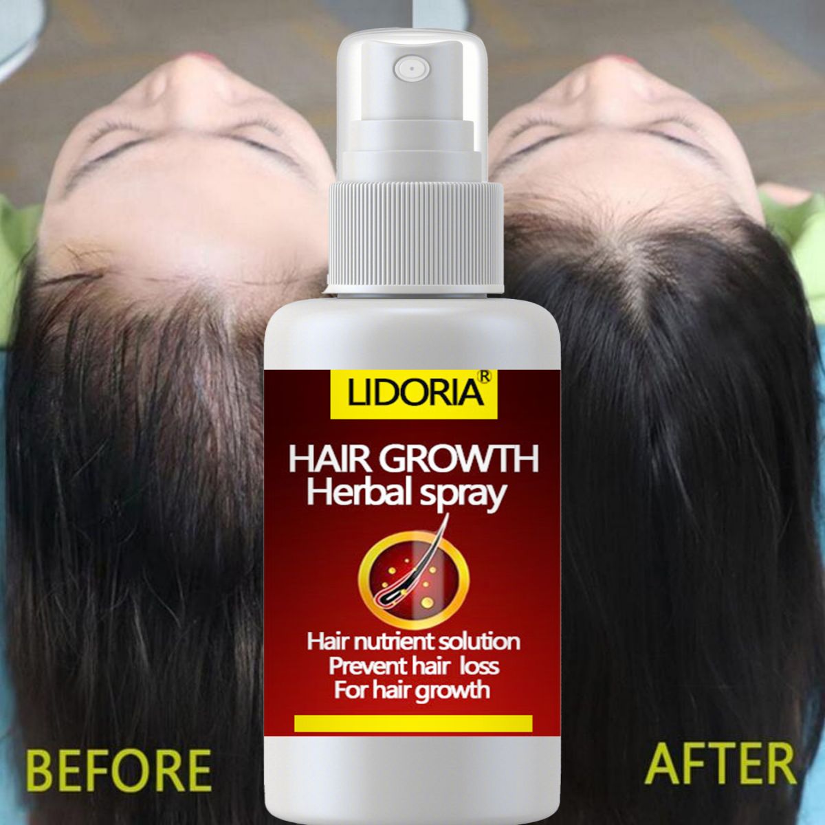 Hair Fast Growth and Hair Care – Hair Care Essential Oil Atomizing recenzja i cena