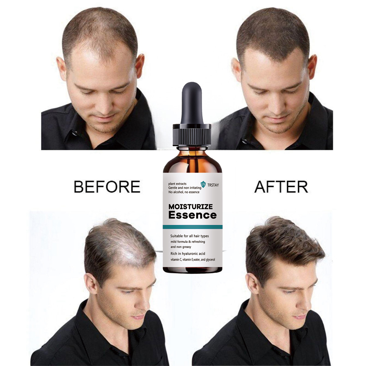 2022 New Hair Growth Essence P – Hair Care Ordinary recenzja i cena