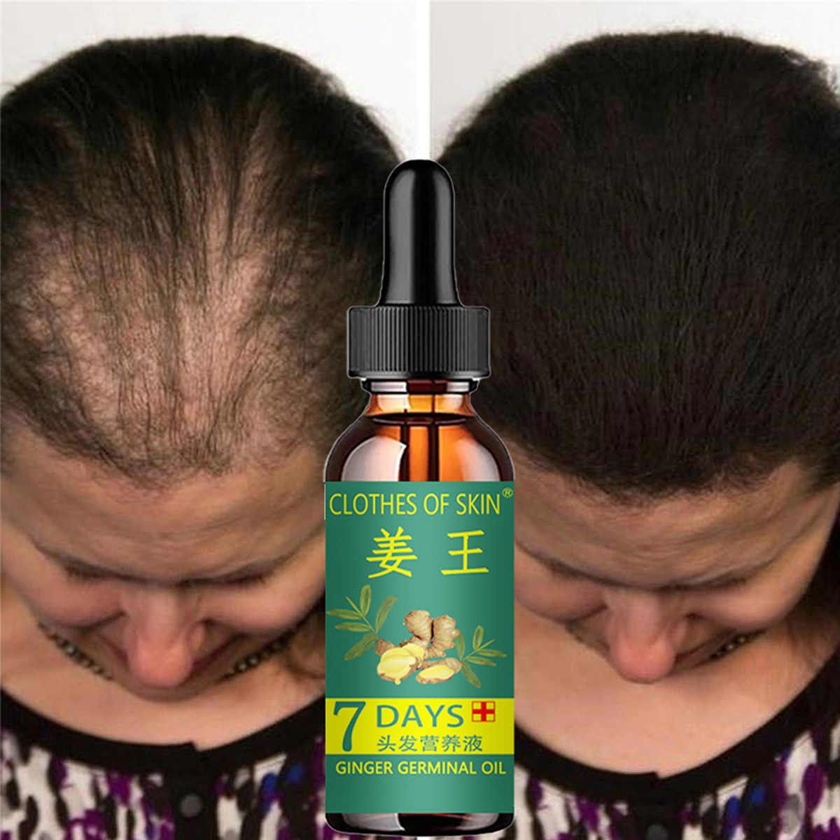 Hair Growth Products Ginger Es – Hair Care Essential Oil Atomizing recenzja i cena