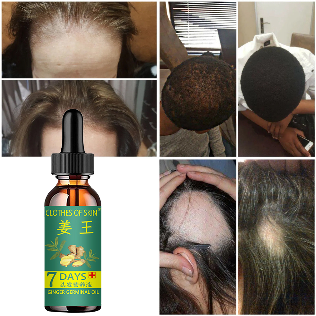 Hair Growth Products Ginger Es – Hair Care Essential Oil Atomizing recenzja i cena