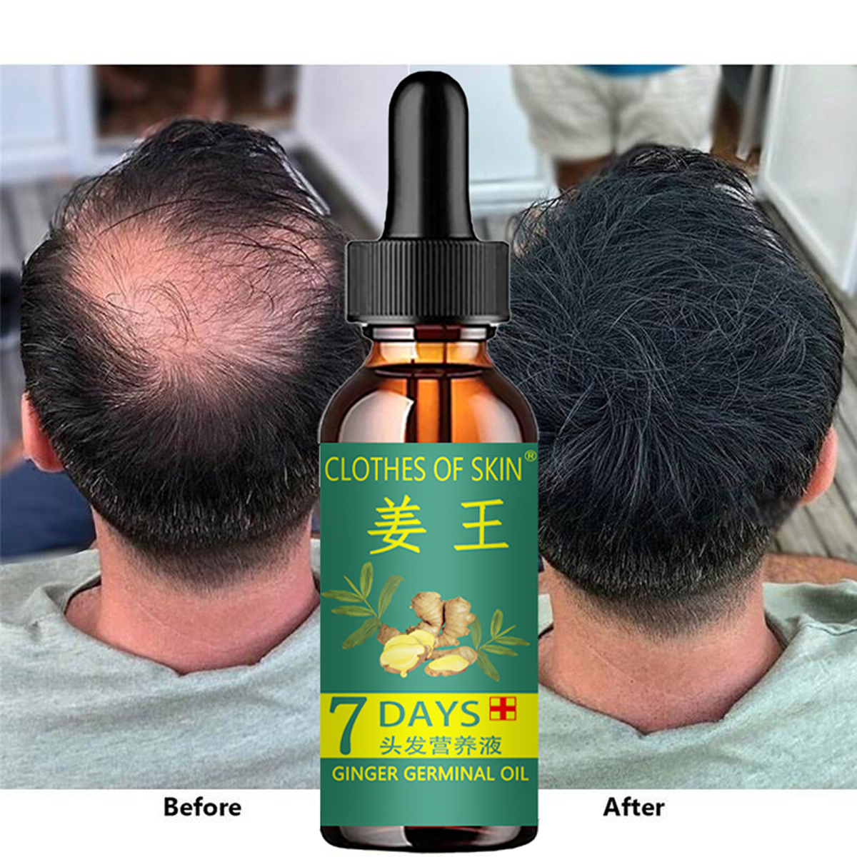 Hair Growth Products Ginger Es – Hair Care Essential Oil Atomizing recenzja i cena