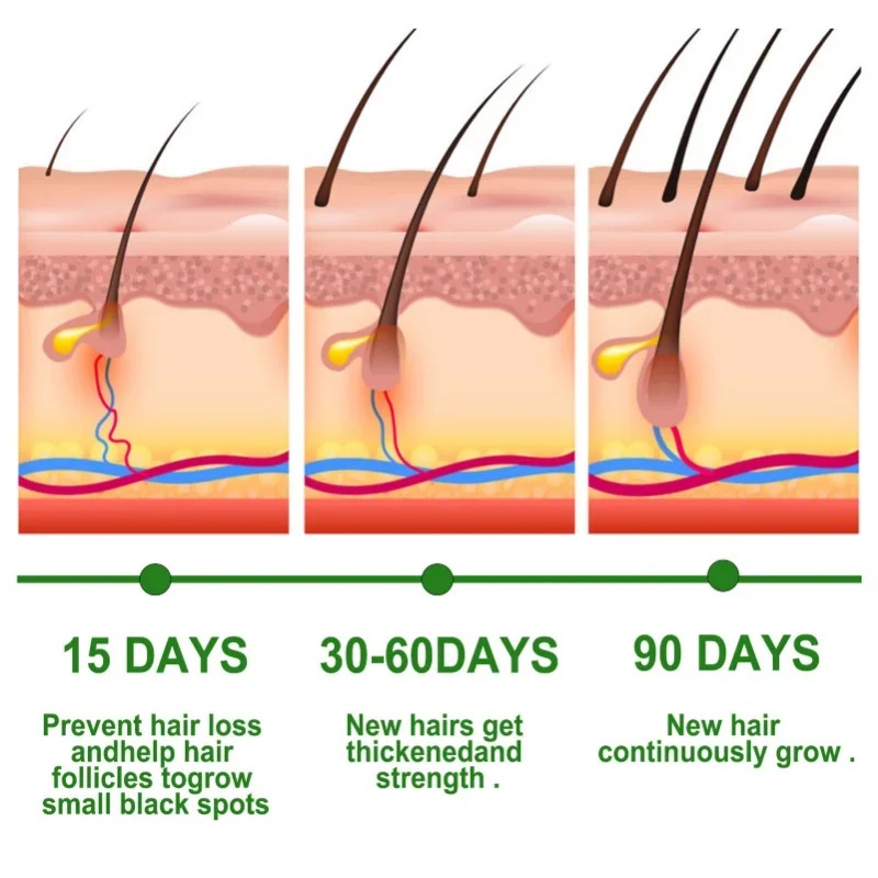 Hair Growth Serum Fast Growing – Hair Care Essence Oil recenzja i cena