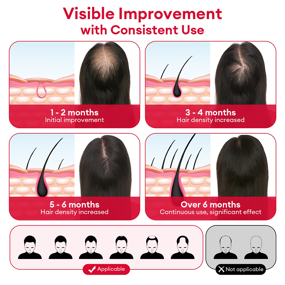 650nm+850nm Red Light Infrared – Hair Care Vegan recenzja i cena