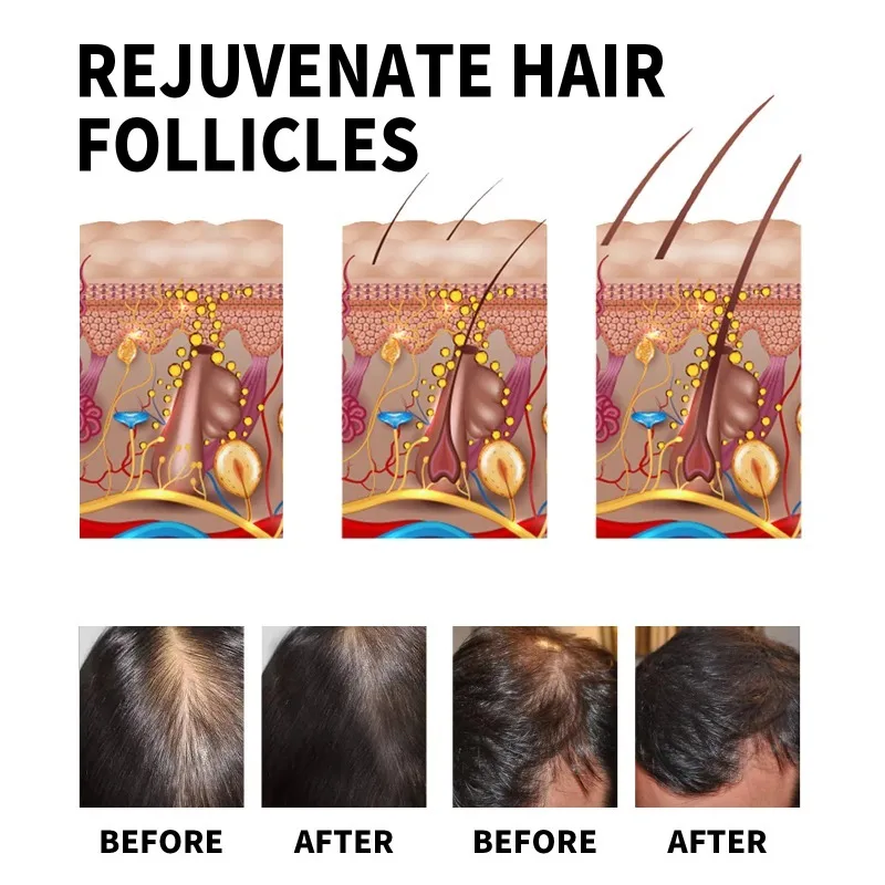 Hair Growth Serum Fast Growing – Hair Care Essential Oil Atomizing recenzja i cena