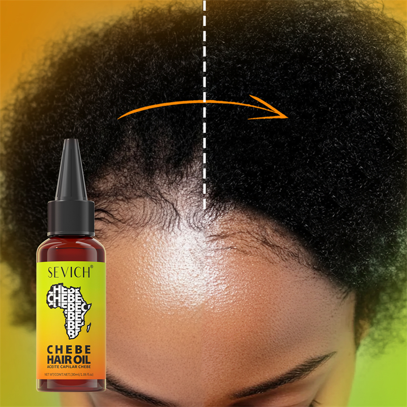 Chebe Fast Hair Growth Oil Afr – Hair Care Essence Oil recenzja i cena