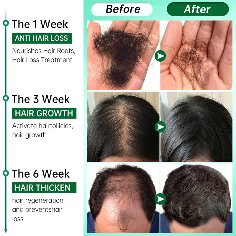 7 Days Fast Grow Hair Growth S – Hair Care Essential Oil Atomizing recenzja i cena