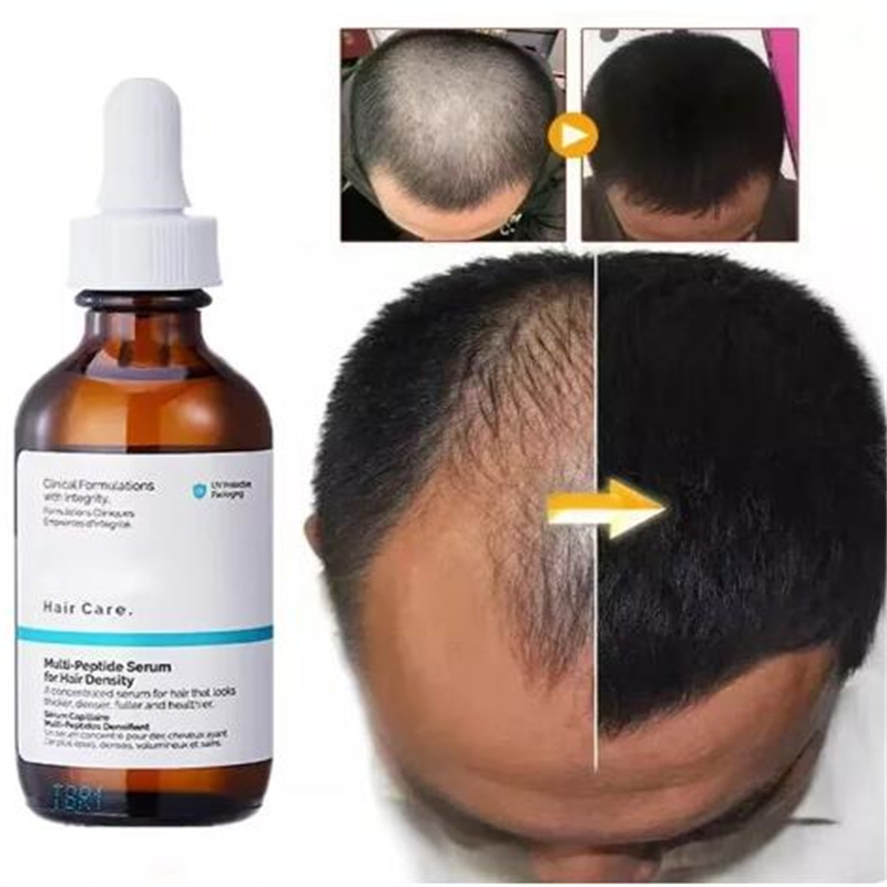60ml Original Hair Growth Esse – Hair Care Ordinary recenzja i cena