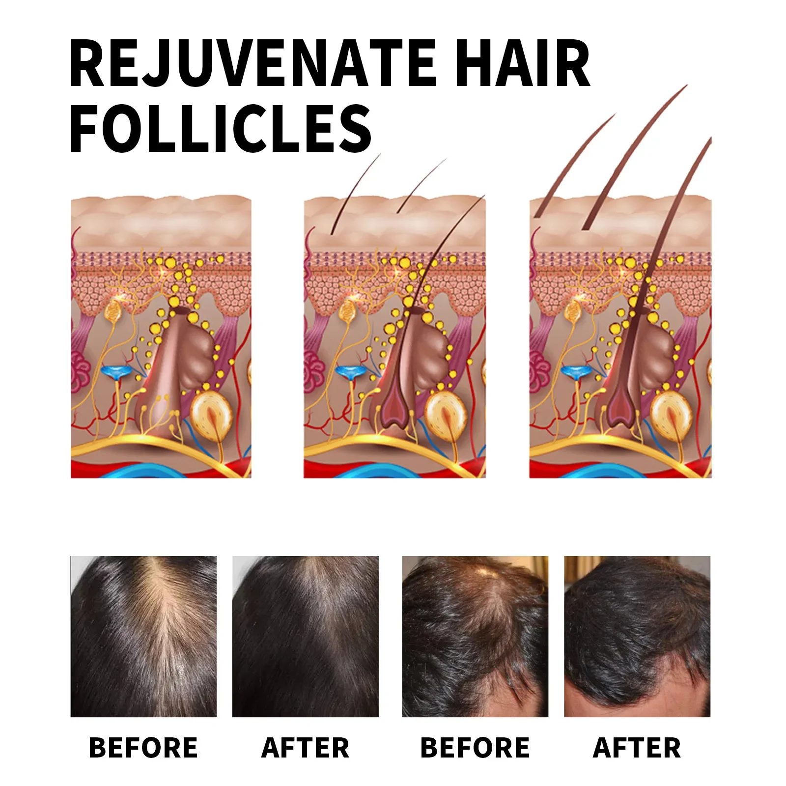 Ginger Hair Growth Products Fa – Hair Care Essential Oil Atomizing recenzja i cena