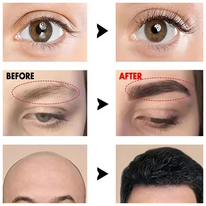 Fast Eyebrow Growth Serum Eyel – Hair Care Oil Serum recenzja i cena