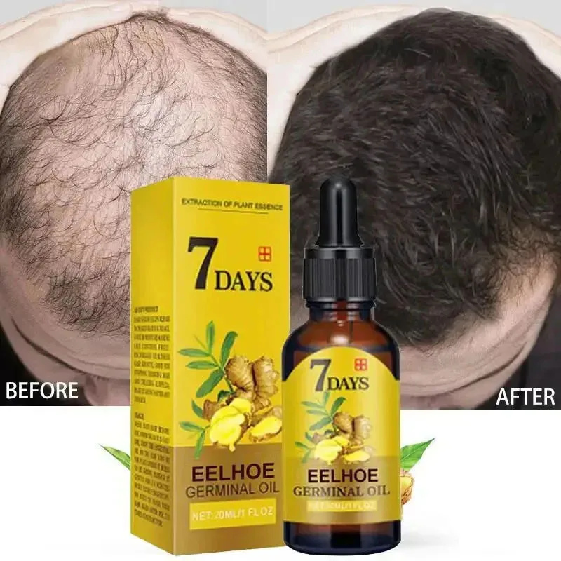 7 Day Fast Hair Growth Serum G – Hair Care Essential Oil Atomizing recenzja i cena