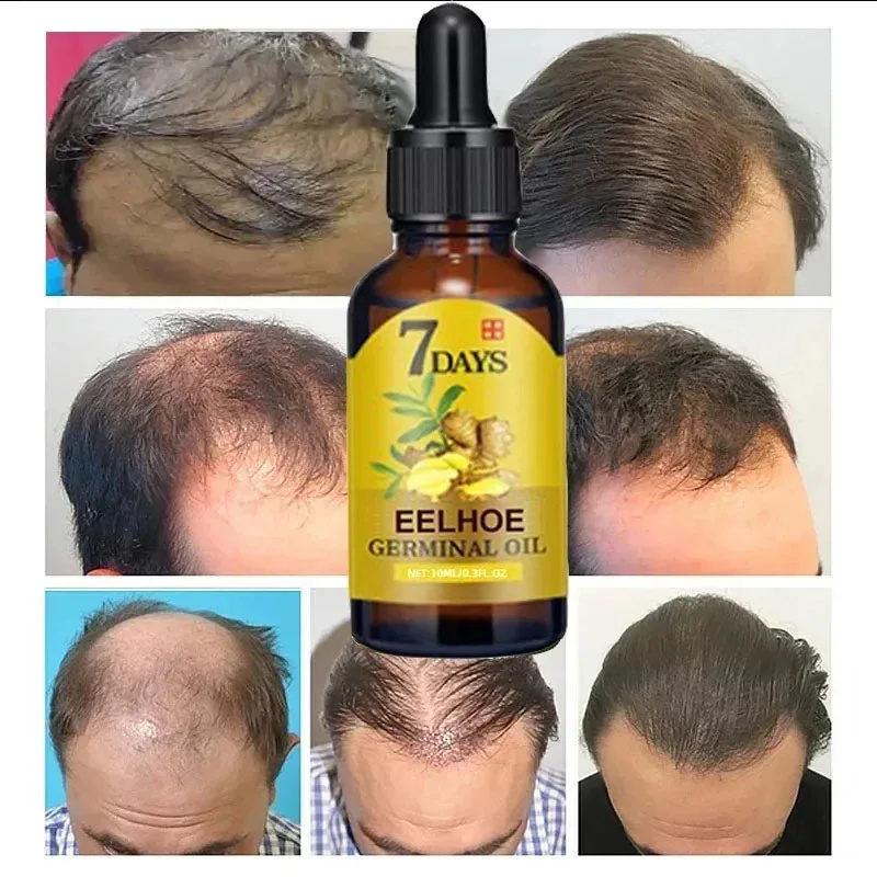 7 Day Fast Hair Growth Serum G – Hair Care Essential Oil Atomizing recenzja i cena