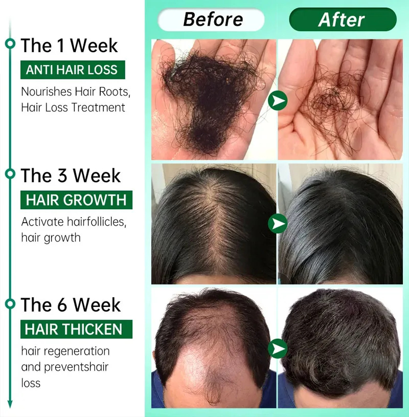 7 Day Fast Hair Growth Serum G – Hair Care Essential Oil Atomizing recenzja i cena