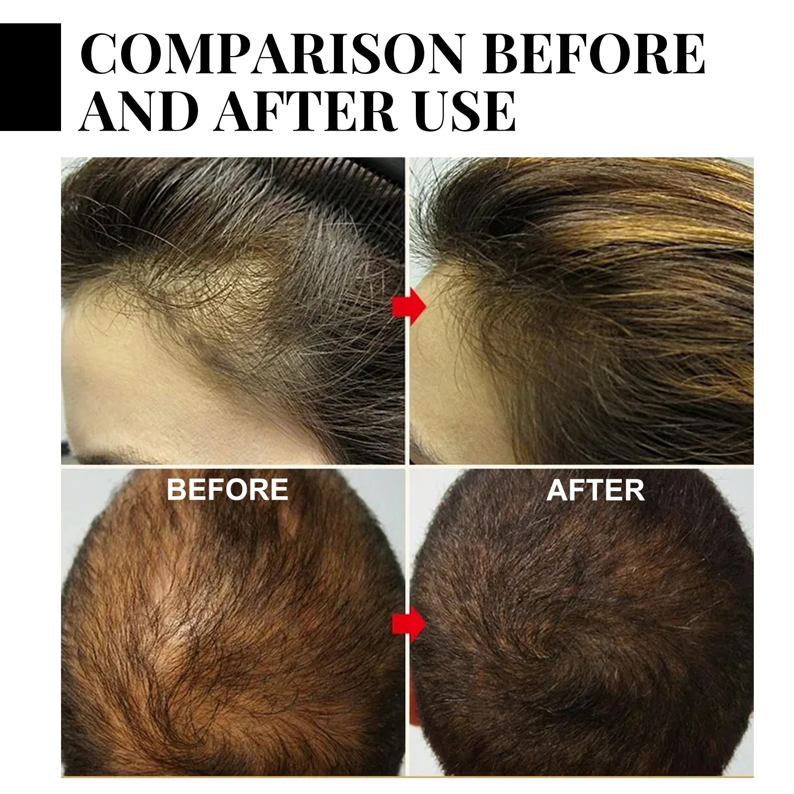 Ginger Hair Growth spray Anti  – Hair Care Vegan recenzja i cena