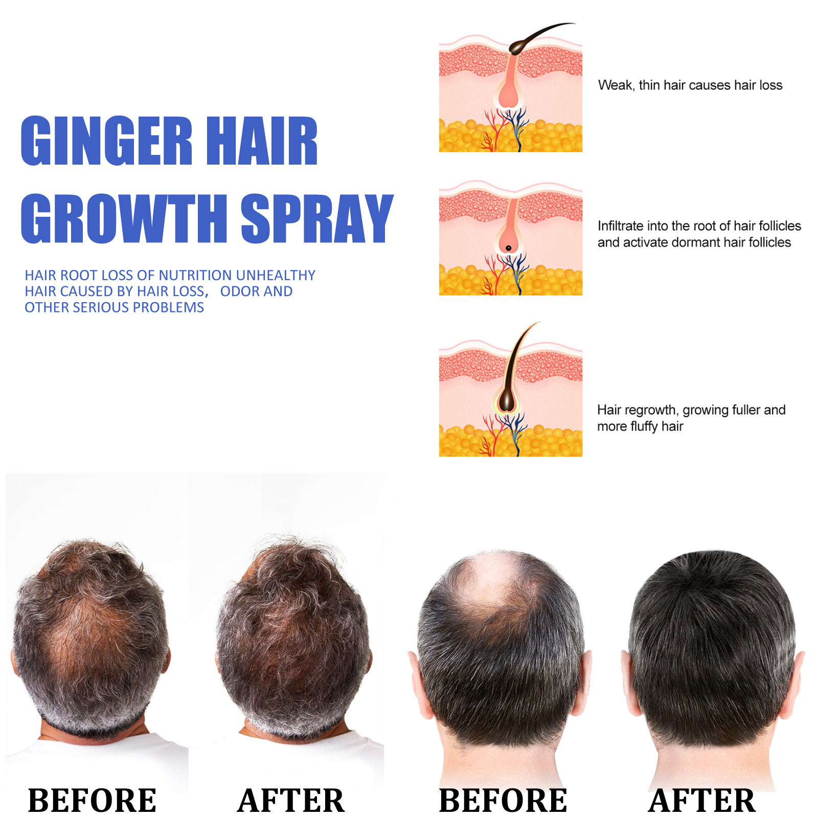 Ginger Hair Growth spray Anti  – Hair Care Vegan recenzja i cena