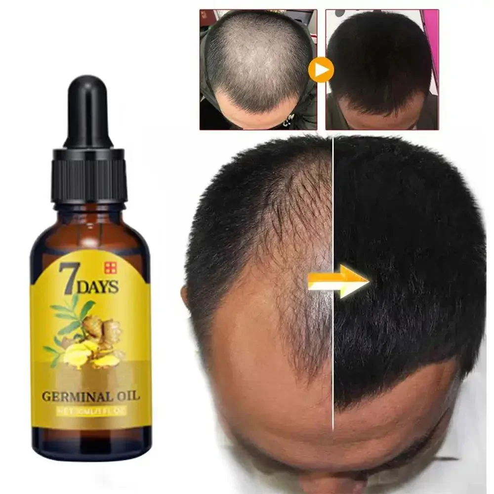 Hair Growth Ginger Fast Growin – Hair Care Essence Oil recenzja i cena