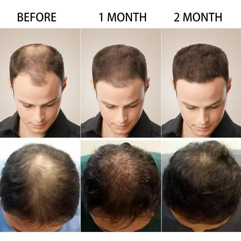 Hair Growth Ginger Fast Growin – Hair Care Essence Oil recenzja i cena