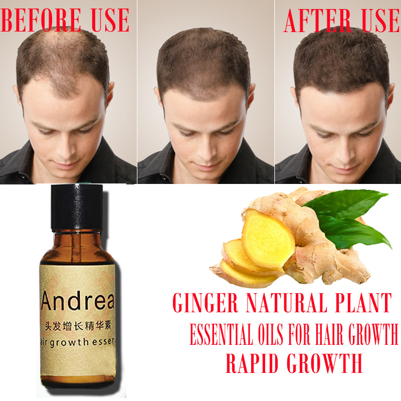2/5/10Pcs Andrea Hair Growth S – Hair Care Essence Oil recenzja i cena