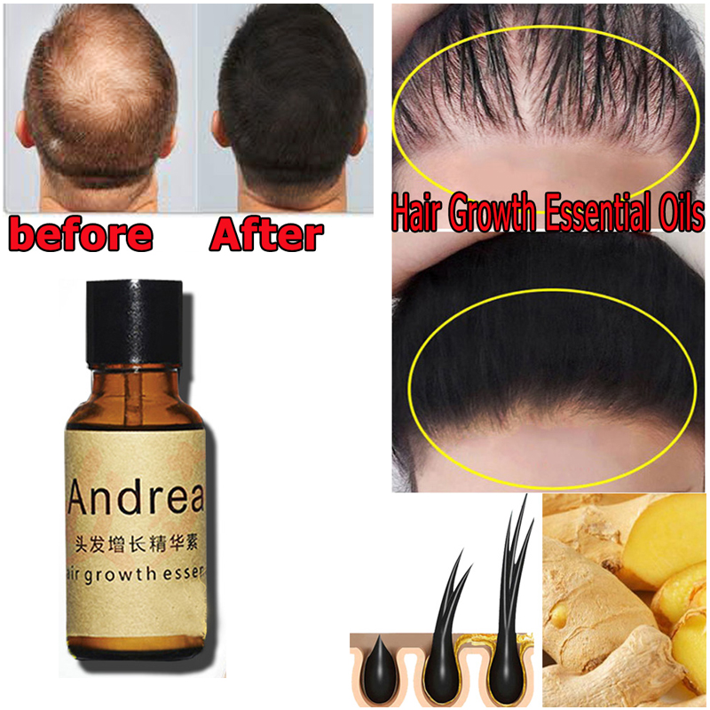 2/5/10Pcs Andrea Hair Growth S – Hair Care Essence Oil recenzja i cena