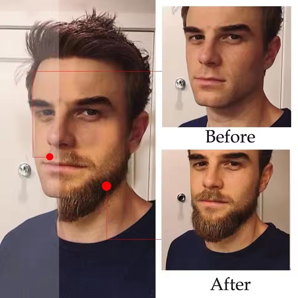 High Quality Fast Beard Growth – Hair Care Essential Oil Atomizing recenzja i cena