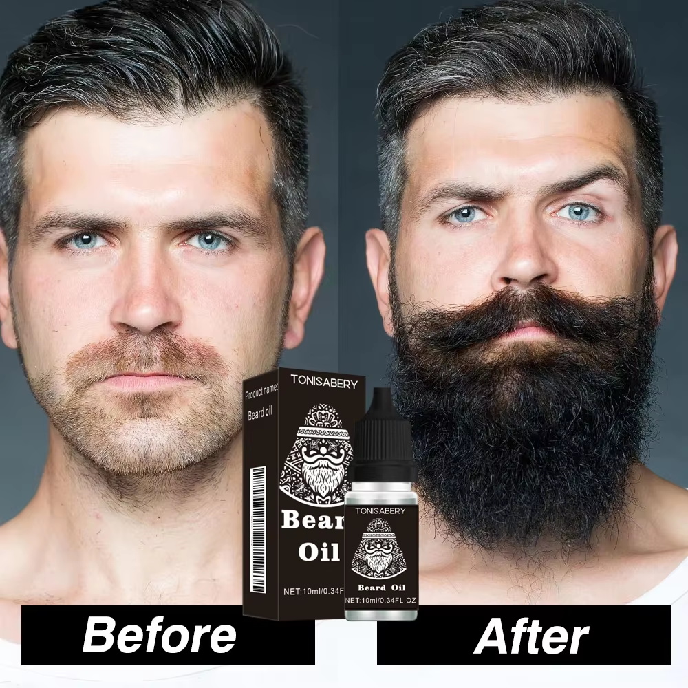 High Quality Fast Beard Growth – Hair Care Essential Oil Atomizing recenzja i cena